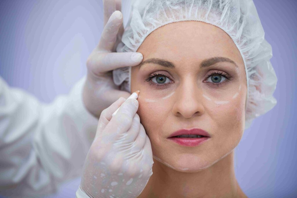 upper eyelid lift Miami